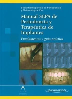 Papel MANUAL SEPA DE PERIODONCIA Y TERAPEUTICA DE IMPLANTES F  UNDAMENTOS Y GUIA PRACTICA (CARTONE)