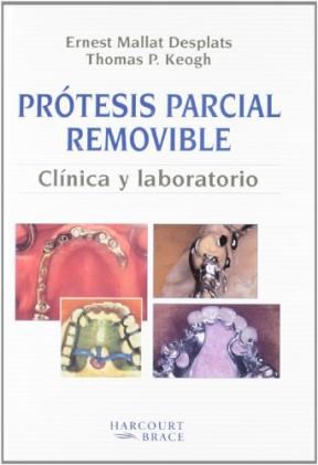 Papel PROTESIS PARCIAL REMOVIBLE COLADA