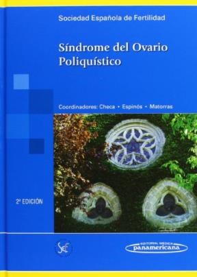 Papel SINDROME DEL OVARIO POLIQUISTICO [2/EDICION] (CARTONE)