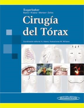 Papel CIRUGIA DEL TORAX (CARTONE)
