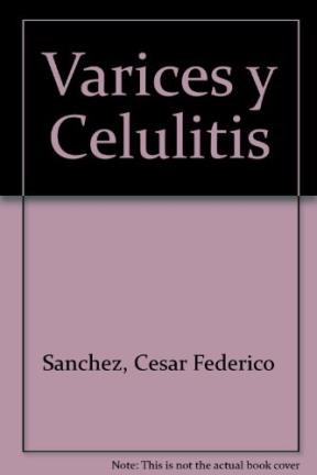 Papel VARICES Y CELULITIS - COMO PREVENIRLAS COMO CURARLAS (D  E LA SALUD)