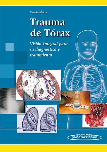 Papel TRAUMA DE TORAX VISION INTEGRAL PARA SU DIAGNOSTICO Y TRATAMIENTO (RUSTICA)