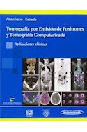 Papel TOMOGRAFIA POR EMISION DE POSITRONES Y TOMOGRAFIA COMPUTARIZADA APLICACIONES CLINICAS