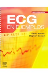Papel ECG EN EJEMPLOS (3 EDICION) (RUSTICO)