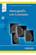 Papel MAMOGRAFIA CON CONTRASTE (INCLUYE VERSION DIGITAL)