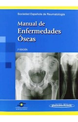 Papel MANUAL DE ENFERMEDADES OSEAS (2 EDICION) (RUSTICO)