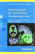 Papel ENFERMEDAD DE ALZHEIMER NEUROLOGIA CASO A CASO (RUSTICA)