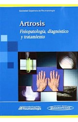Papel ARTROSIS FISIOPATOLOGIA DIAGNOSTICO Y TRATAMIENTO