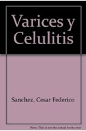 Papel VARICES Y CELULITIS - COMO PREVENIRLAS COMO CURARLAS (D  E LA SALUD)