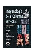 Papel IMAGENOLOGIA DE LA COLUMNA VERTEBRAL (SERIE EXPERTO EN  RADIOLOGIA) (CARTONE)