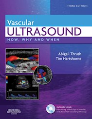E-book Vascular Ultrasound