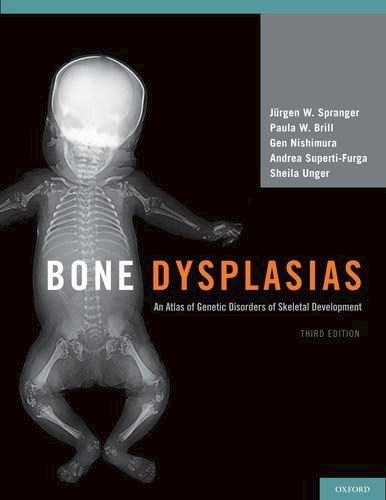 Papel Bone dysplasias, an atlas of genetic disorders of skeletal development