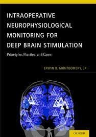 Papel Intraoperative neurophysiological monitoring for deep brain stimulation: principles, practice, and s