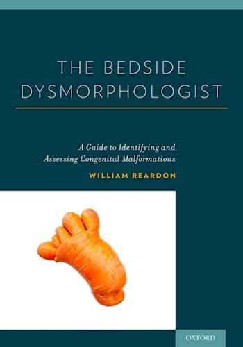Papel The bedside dysmorphologist: a guide to identifying and assessing congenital malformations
