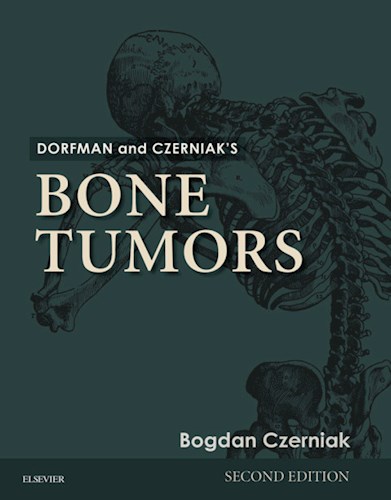  Dorfman And Czerniak’S Bone Tumors