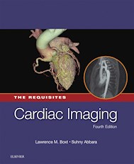 E-book Cardiac Imaging: The Requisites E-Book