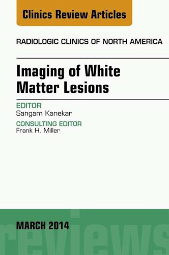 E-book Imaging of White Matter, An Issue of Radiologic Clinics of North America