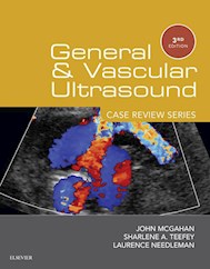 E-book General And Vascular Ultrasound: Case Review Series