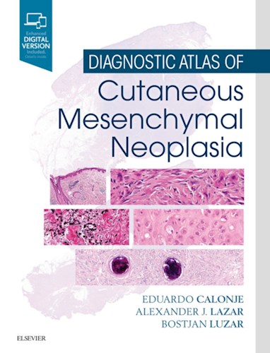 E-book Diagnostic Atlas of Cutaneous Mesenchymal Neoplasia