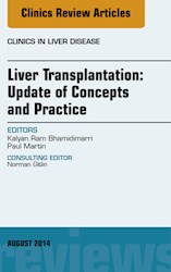 E-book Liver Transplantation: Update Of Concepts And Practice, An Issue Of Clinics In Liver Disease