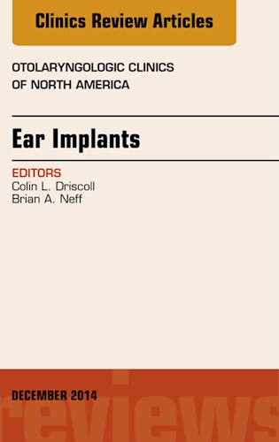 E-book Ear Implants, An Issue of Otolaryngologic Clinics of North America