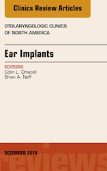 E-book Ear Implants, An Issue Of Otolaryngologic Clinics Of North America