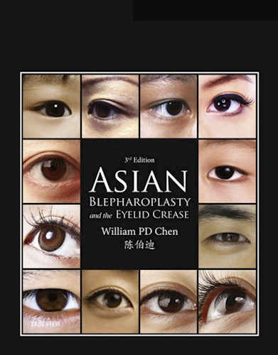 E-book Asian Blepharoplasty and the Eyelid Crease