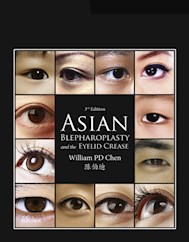 E-book Asian Blepharoplasty And The Eyelid Crease