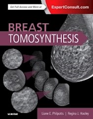 Papel Breast Tomosynthesis