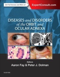 Papel Diseases and Disorders of the Orbit and Ocular Adnexa