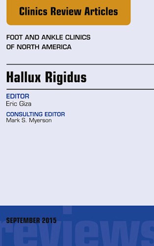 E-book Hallux Rigidus, An Issue of Foot and Ankle Clinics of North America