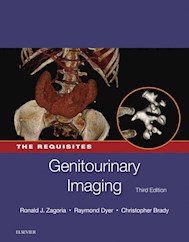 E-book Genitourinary Imaging: The Requisites