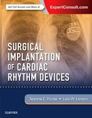 Papel+Digital Surgical Implantation Of Cardiac Rhythm Devices
