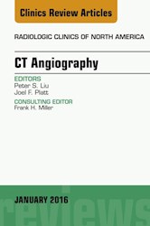 E-book Ct Angiography, An Issue Of Radiologic Clinics Of North America