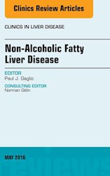 E-book Non-Alcoholic Fatty Liver Disease, An Issue Of Clinics In Liver Disease