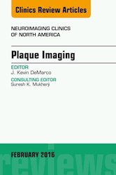 E-book Plaque Imaging, An Issue Of Neuroimaging Clinics Of North America