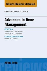 E-book Advances In Acne Management, An Issue Of Dermatologic Clinics