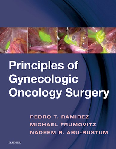 E-book Principles of Gynecologic Oncology Surgery