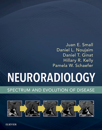 E-book Neuroradiology