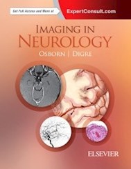 Papel Imaging In Neurology