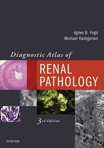  Diagnostic Atlas Of Renal Pathology E-Book