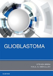 E-book Glioblastoma