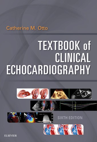 E-book Textbook of Clinical Echocardiography