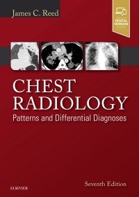 Papel+Digital Chest Radiology: Patterns and Differential Diagnoses