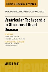 E-book Ventricular Tachycardia In Structural Heart Disease, An Issue Of Cardiac Electrophysiology Clinics