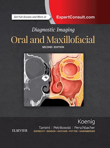 E-book Diagnostic Imaging: Oral and Maxillofacial