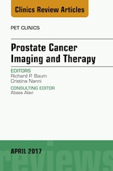 E-book Prostate Cancer Imaging And Therapy, An Issue Of Pet Clinics