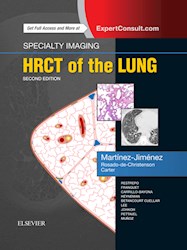 E-book Specialty Imaging: Hrct Of The Lung