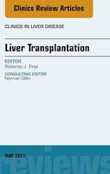 E-book Liver Transplantation, An Issue Of Clinics In Liver Disease