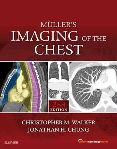 E-book Muller's Imaging of the Chest E-Book